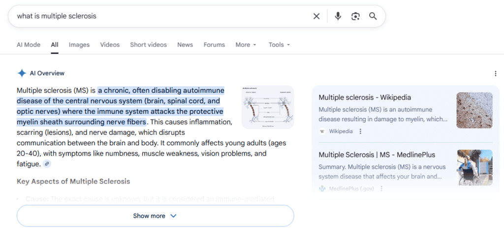 AI Overview answer on what is multiple scleroris. 